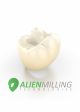 Alien HT Implant Zirconia Crown on Sale