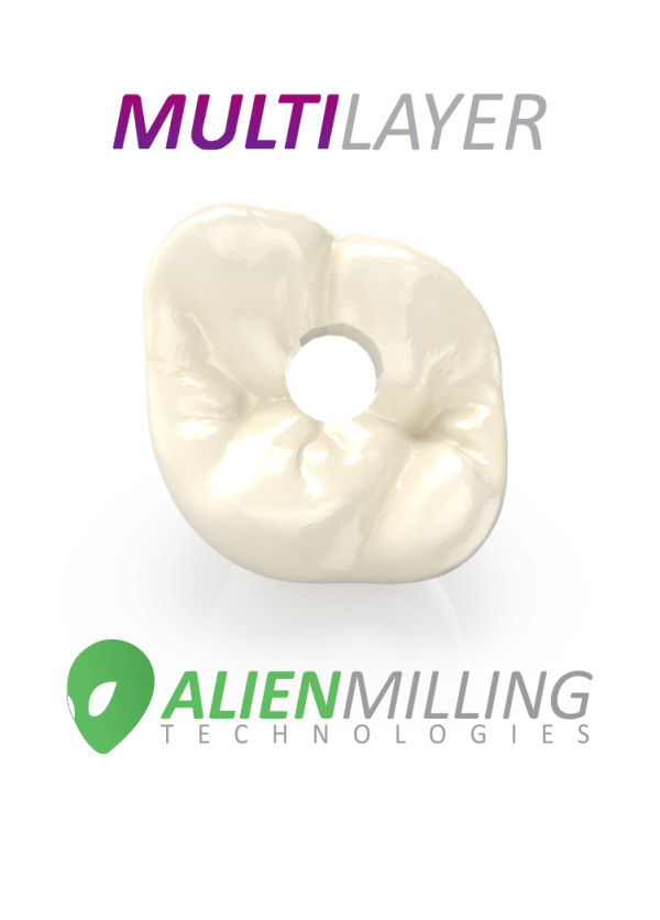 Alien Multi-Layer Implant Zirconia Crown Supply